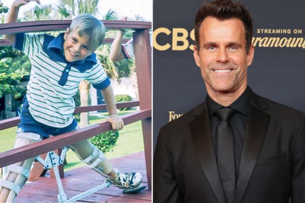 Cameron Mathison Was ‘Bullied’ for Leg Braces as a Child: ‘I Was the Guy Mothers Told Their Kids Not to Stare at’