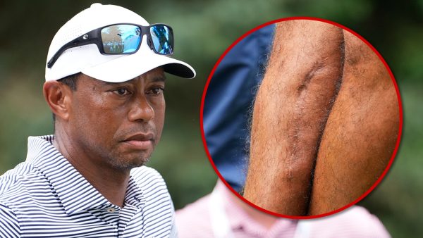 Tiger Woods Shows Off Gnarly Leg Scars Three Years After Car Crash