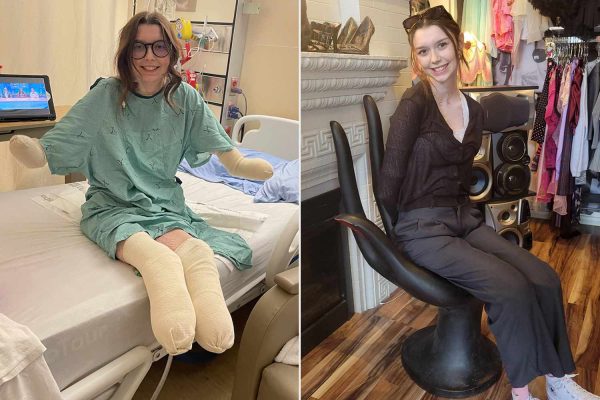 Teen Doesn’t Realize She’s Experiencing Symptoms of Septic Shock. Now She’s Living as Quadruple Amputee (Exclusive)