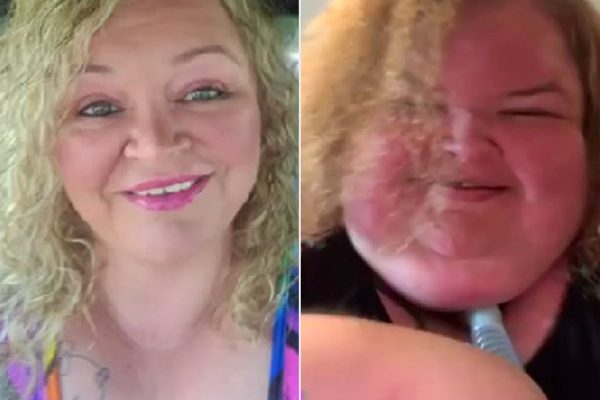 Tammy Slaton’s Sister Amanda Shares Photos from Rehab Before Her 500-Lb. Weight Loss: ‘We Are So Proud’